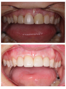 NEW smile- CUTE life